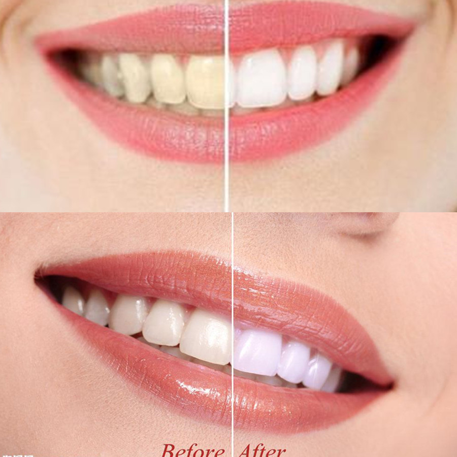 Bambu kömür diş diş diş hekimi - Teeth Whitening Q&M incelemesi ve fiyatı