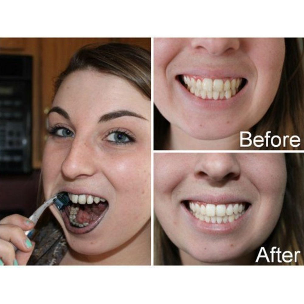 Bambu kömür diş diş diş hekimi - Teeth Whitening Q&M incelemesi ve fiyatı