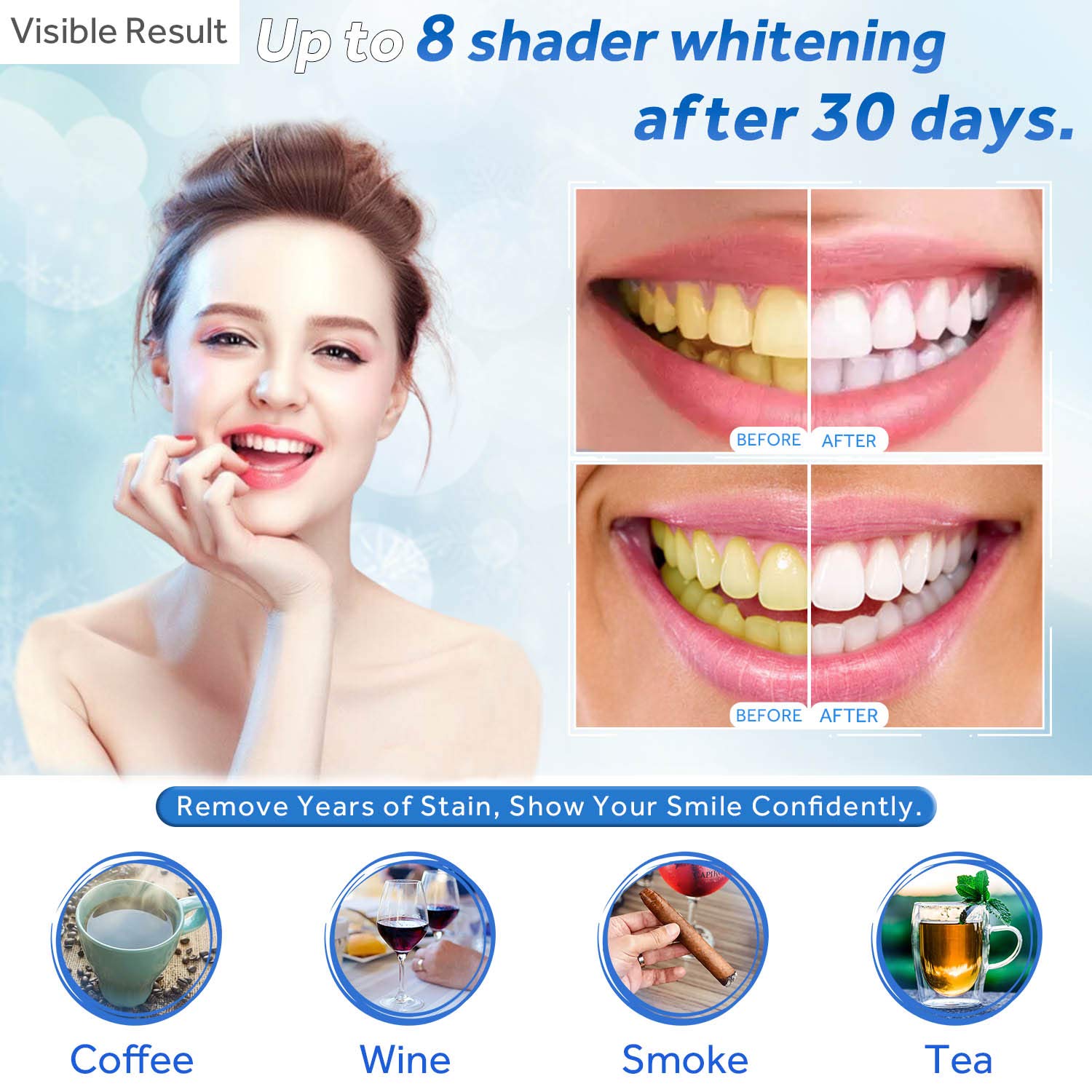Diş Beyazlatma Jeli Dolum Şırı - Teeth Whitening Q&M incelemesi ve fiyatı