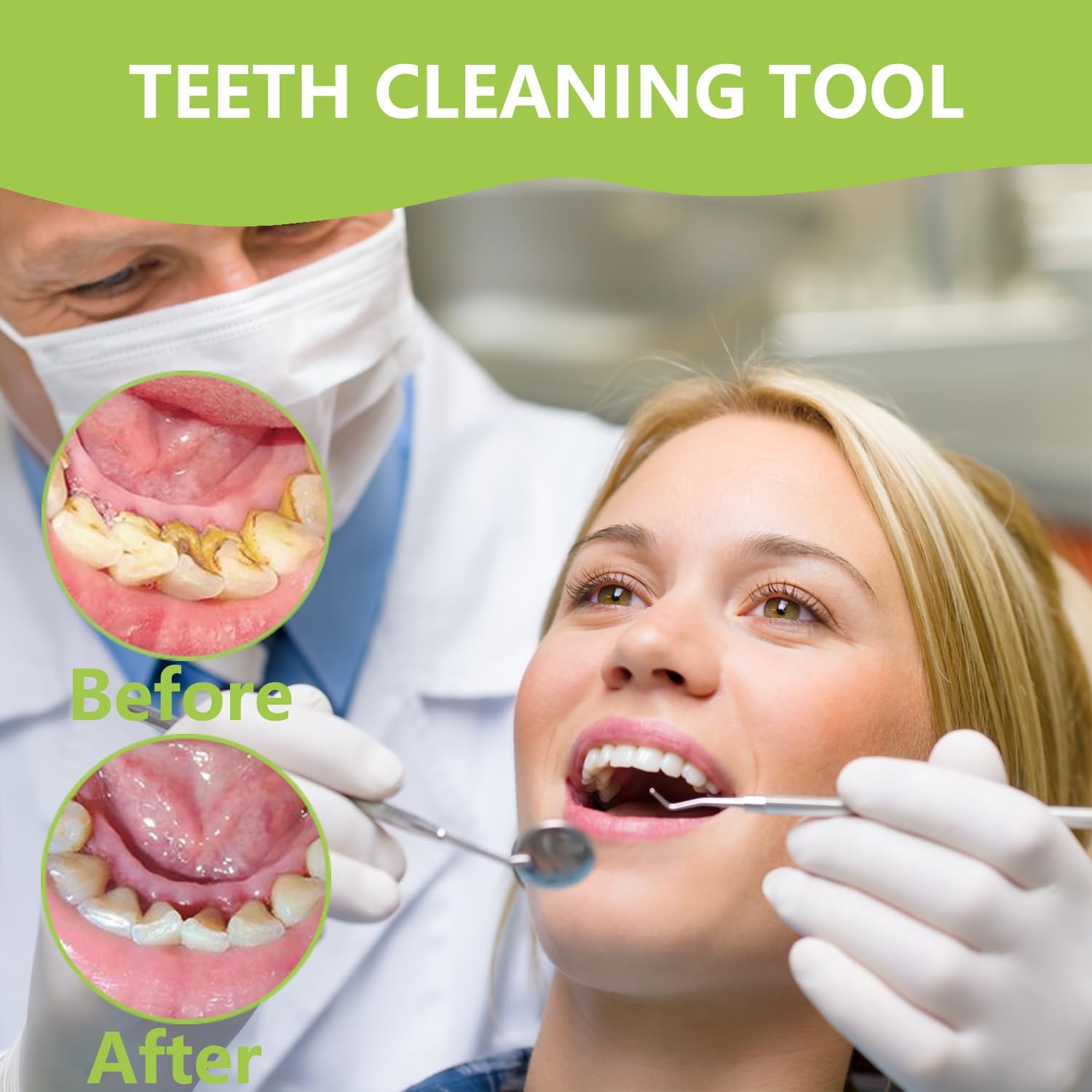 Profesyonel Diş Temizleme Ağız - Teeth Whitening Machine Professional incelemesi ve fiyatı