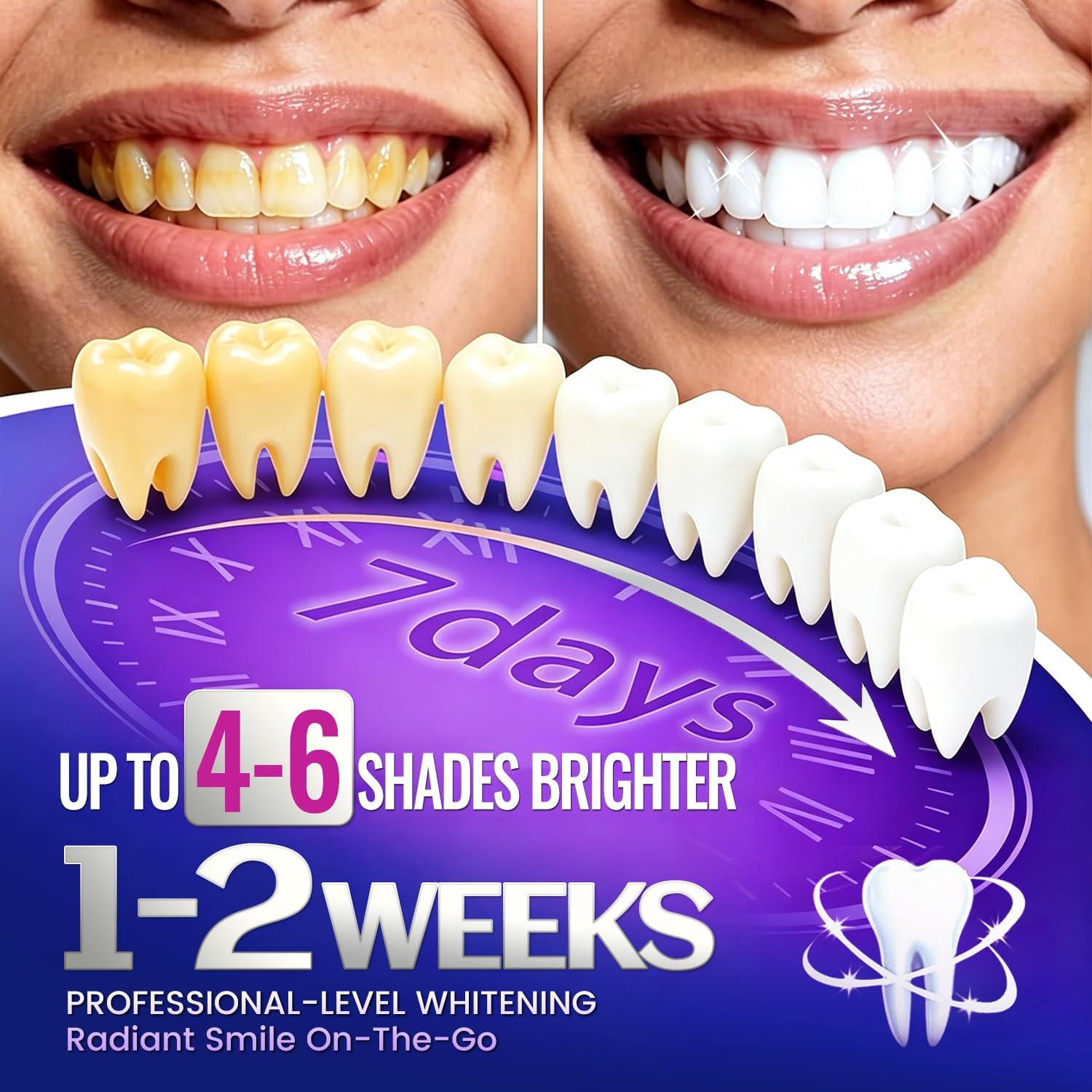Daha Beyaz Görünümlü Bir Gülüm - Teeth Whitening Retainer incelemesi ve fiyatı