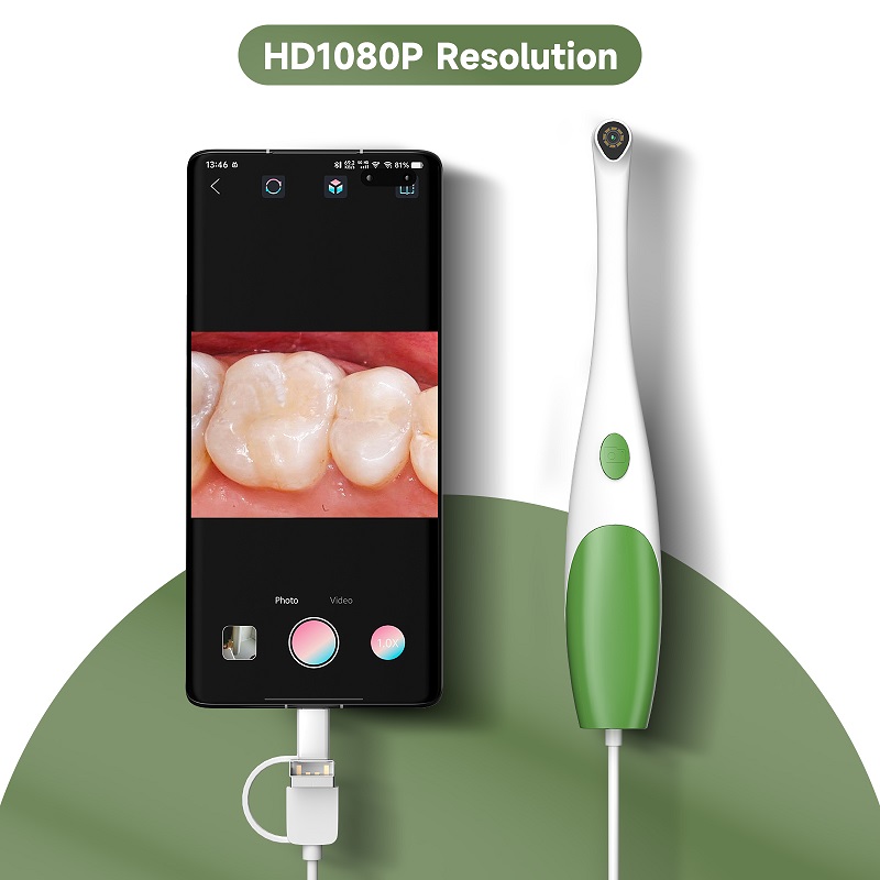 TYPE-C Oral Endoskop El Tipi V - Teeth Whitening Video incelemesi ve fiyatı