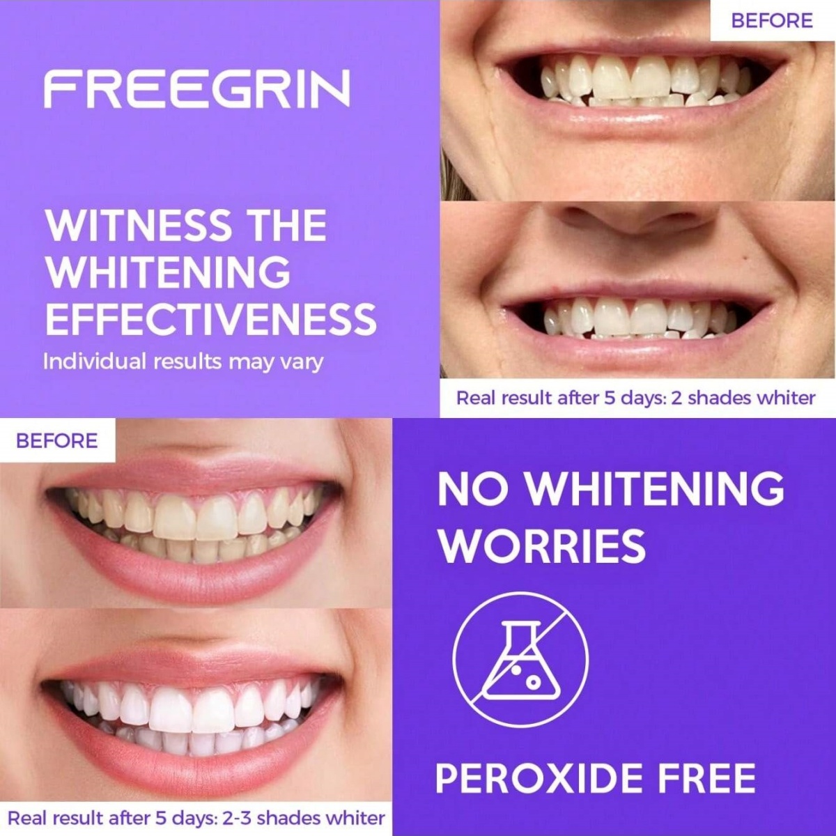 Deluxe Beyazlatma Diş Çıkartma - Teeth Whitening Near Me incelemesi ve fiyatı