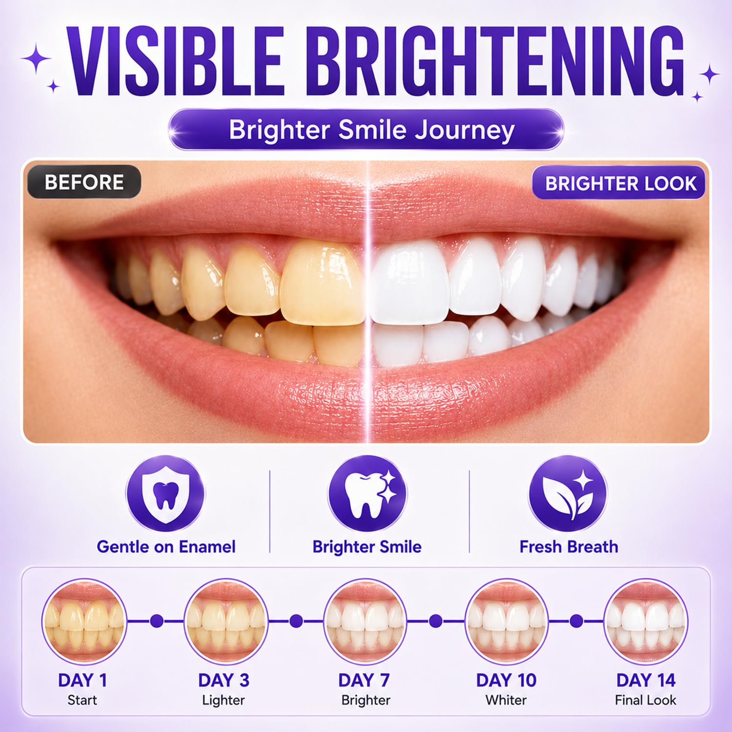 7/14/21 adet Mor Diş Beyazlatm - Teeth Whitening Retainer incelemesi ve fiyatı